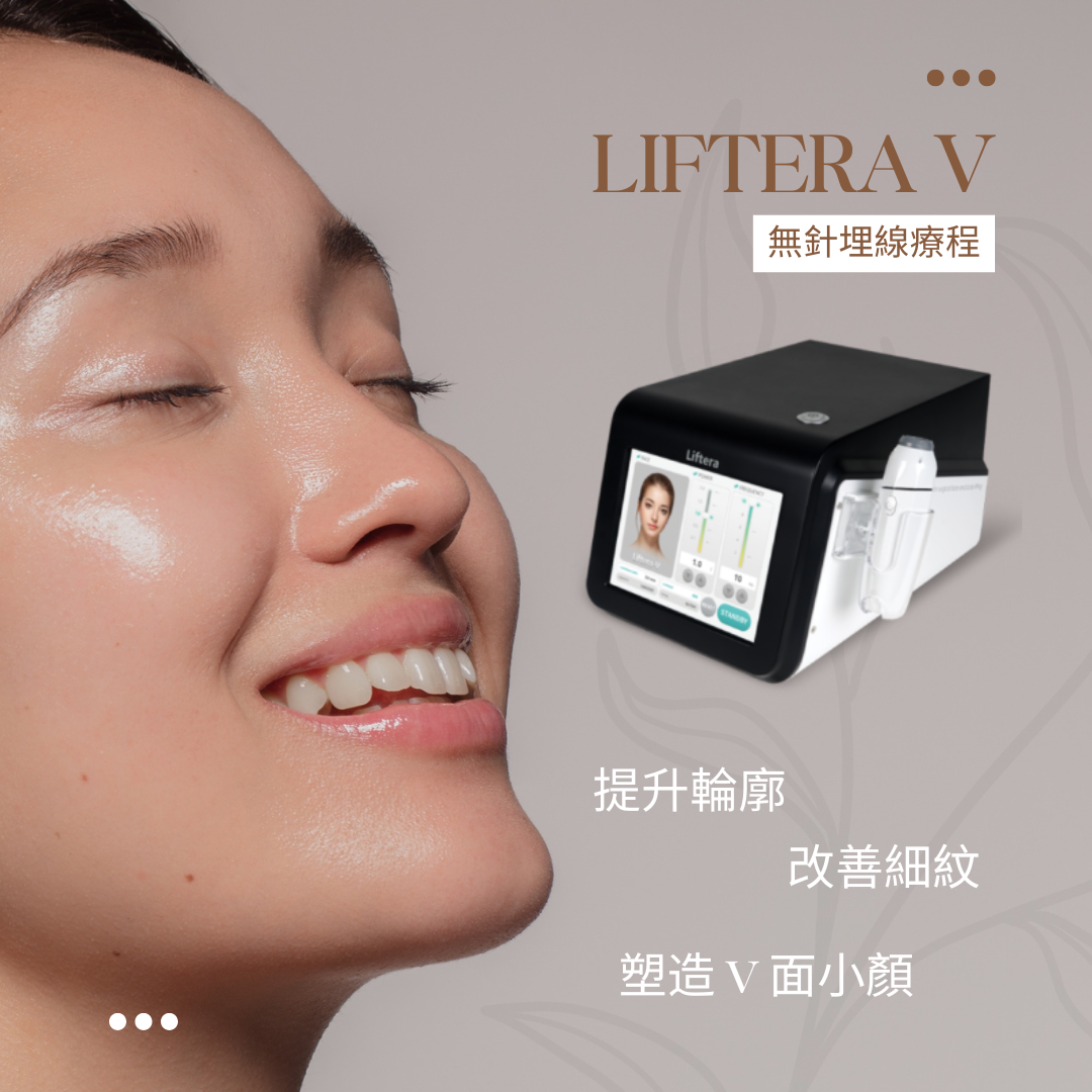 【療程介紹】Liftera V 無針埋線拉提｜無創提拉輪廓 重拾緊緻小顏